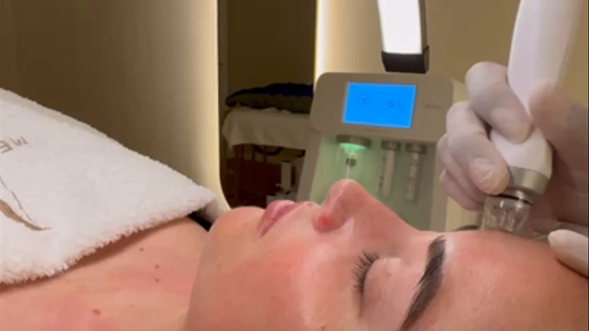 Higiene facial con punta de diamante