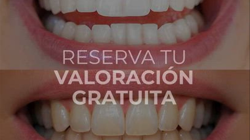 Smilyn - Blanqueamiento Dental