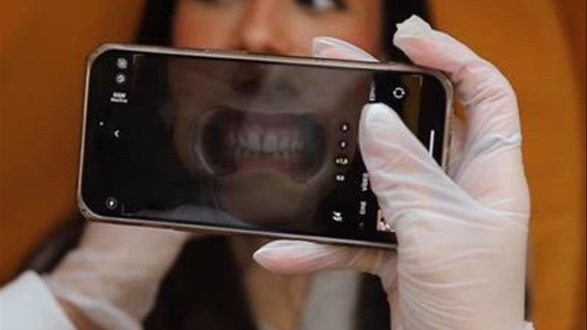 Smilyn - Blanqueamiento Dental