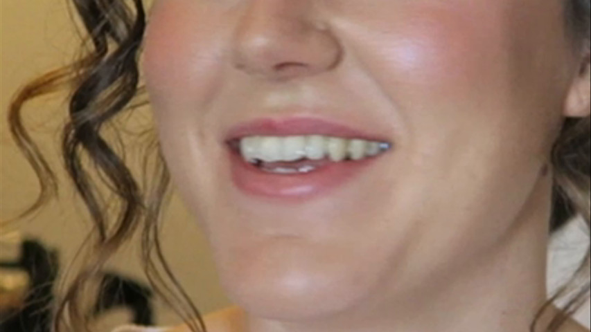 Gemma 