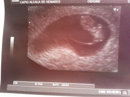 El consultorio de Lita para futuras mamis 1