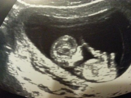 El consultorio de Lita para futuras mamis 5