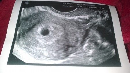 El consultorio de Lita para futuras mamis 4