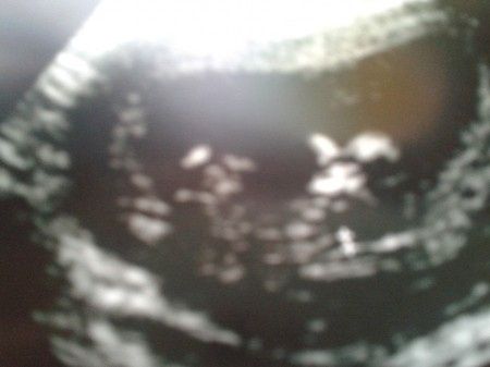 El consultorio de Lita para futuras mamis 3