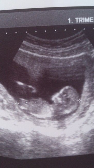 El consultorio de Lita para futuras mamis 2