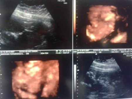 El consultorio de Lita para futuras mamis 1