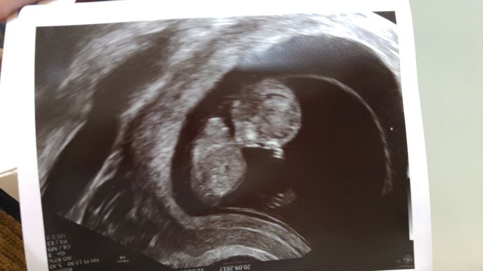Futuras mamás Abril de 2018! 1