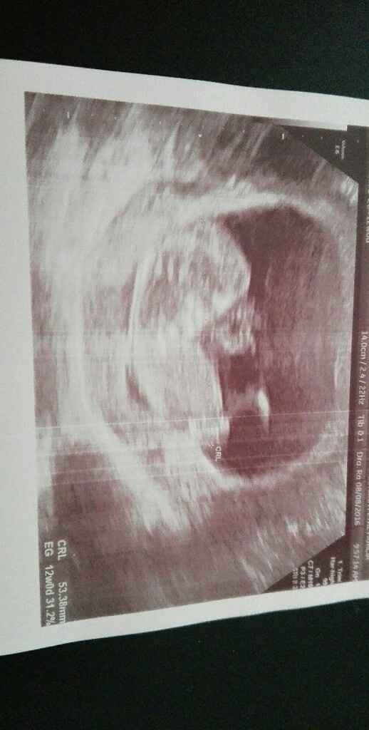 Futuras mamas febrero 2017 - 1