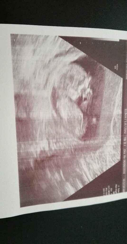 Futuras mamas febrero 2017 - 2
