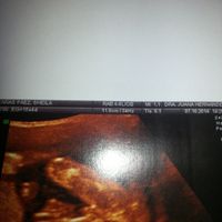 El consultorio de Lita para futuras mamis - 1