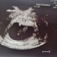 Futuras mamis Junio 2023 - 1