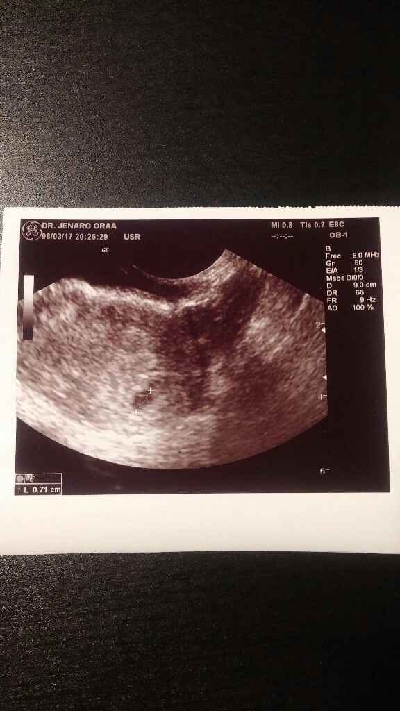 Nuevo! futuras mamis noviembre 2017 - 1