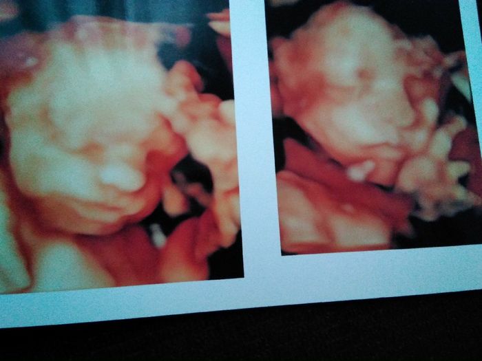 Nuevo! futuras mamis noviembre 2017 - 2