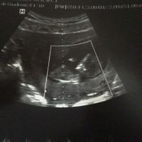 Mamis de junio 2017 - 1