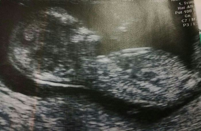 ¡nuevo! futuras mamis marzo 2018 - 1
