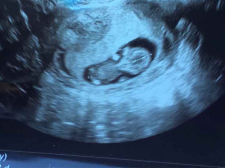 Mamis julio 2017 - 1