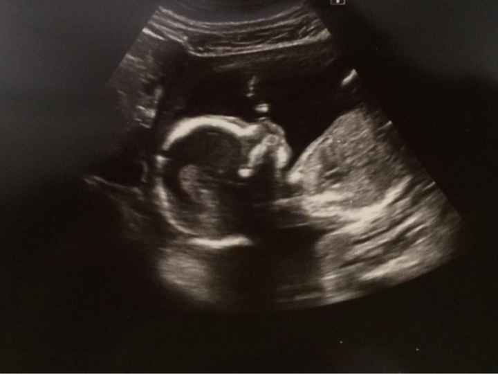 Mamis julio 2017 - 1