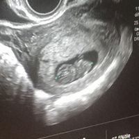 Mamis julio 2017 - 1