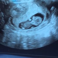 Mamis julio 2017 - 1