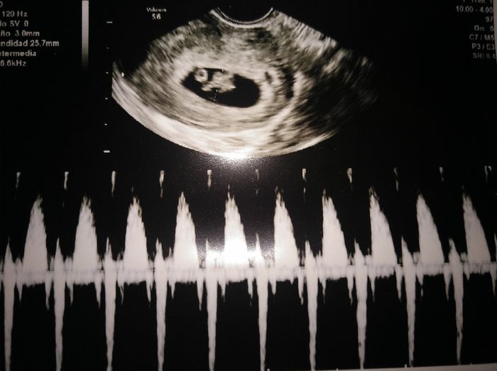 Futuras Mamas Julio 2020. - 1