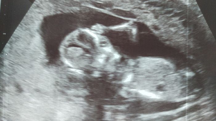 Futuras Mamas Julio 2020. - 2