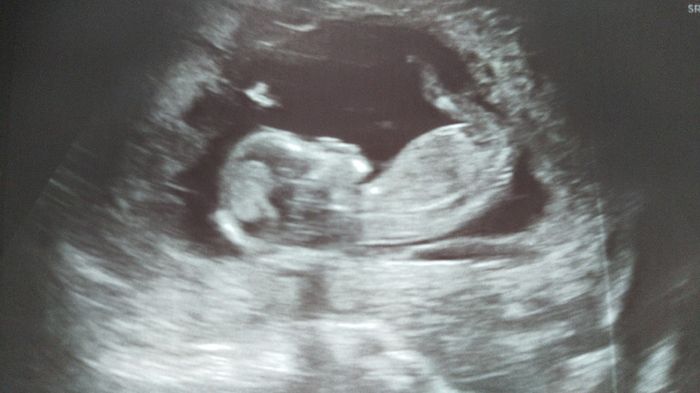 Futuras Mamas Julio 2020. - 3