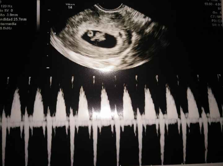 Futuras Mamas Julio 2020. - 1