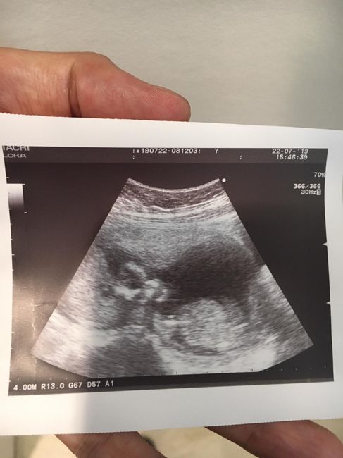 Futuras mamis Enero 2020 1