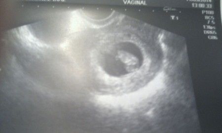 Mamas Abril 2015 - 1