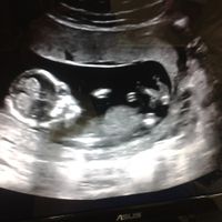 Mamas Abril 2015 - 8