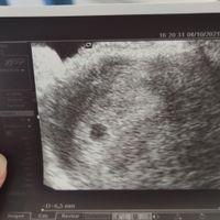 Futuras mamis Junio 2022!! - 1