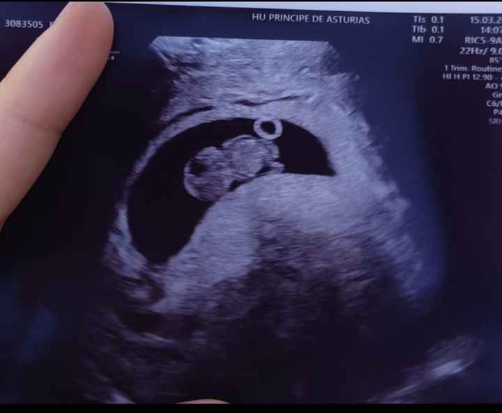 Método Ramzi - 1