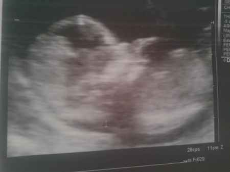 El consultorio de Lita para futuras mamis - 1