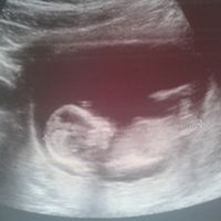 El consultorio de Lita para futuras mamis - 1