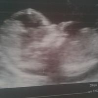 El consultorio de Lita para futuras mamis - 1