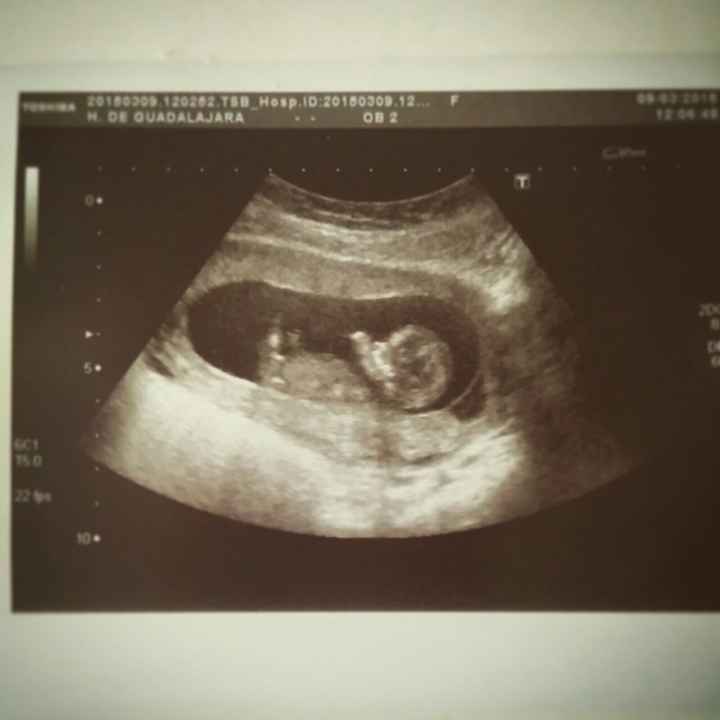 12Semanas