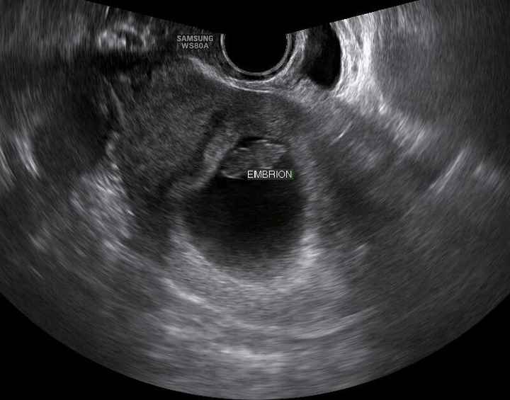 8 semanas y 5 dias