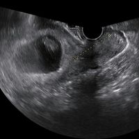 8 semanas y 5 dias