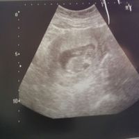 Esta es de hoy 11 semanas y 5 días que pensáis? 