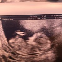 Futuras mamás Junio 2019 - 1