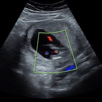 Futuras mamás Junio 2019 - 1