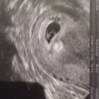 Futuras mamas diciembre 2019 - 1