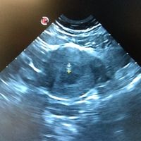 Futuras mamis Marzo 2021 ❤️❤️ - 1