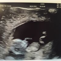 Futuras mamas octubre 2020 - 1