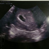 Futuras mamás abril 2017 - 1