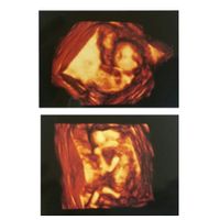 Futuras mamás abril 2017 - 1