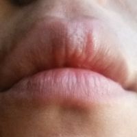 Herpes labial a 4 dias de la boda!!! - 1