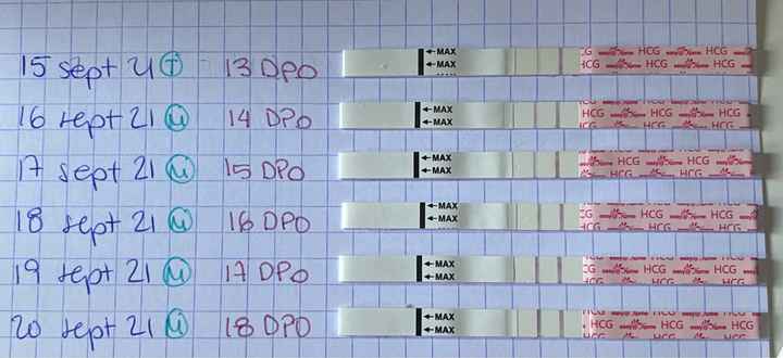 Proceso tratamiento fiv - 2