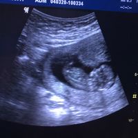 Futuras mamás Septiembre 2020 - 1
