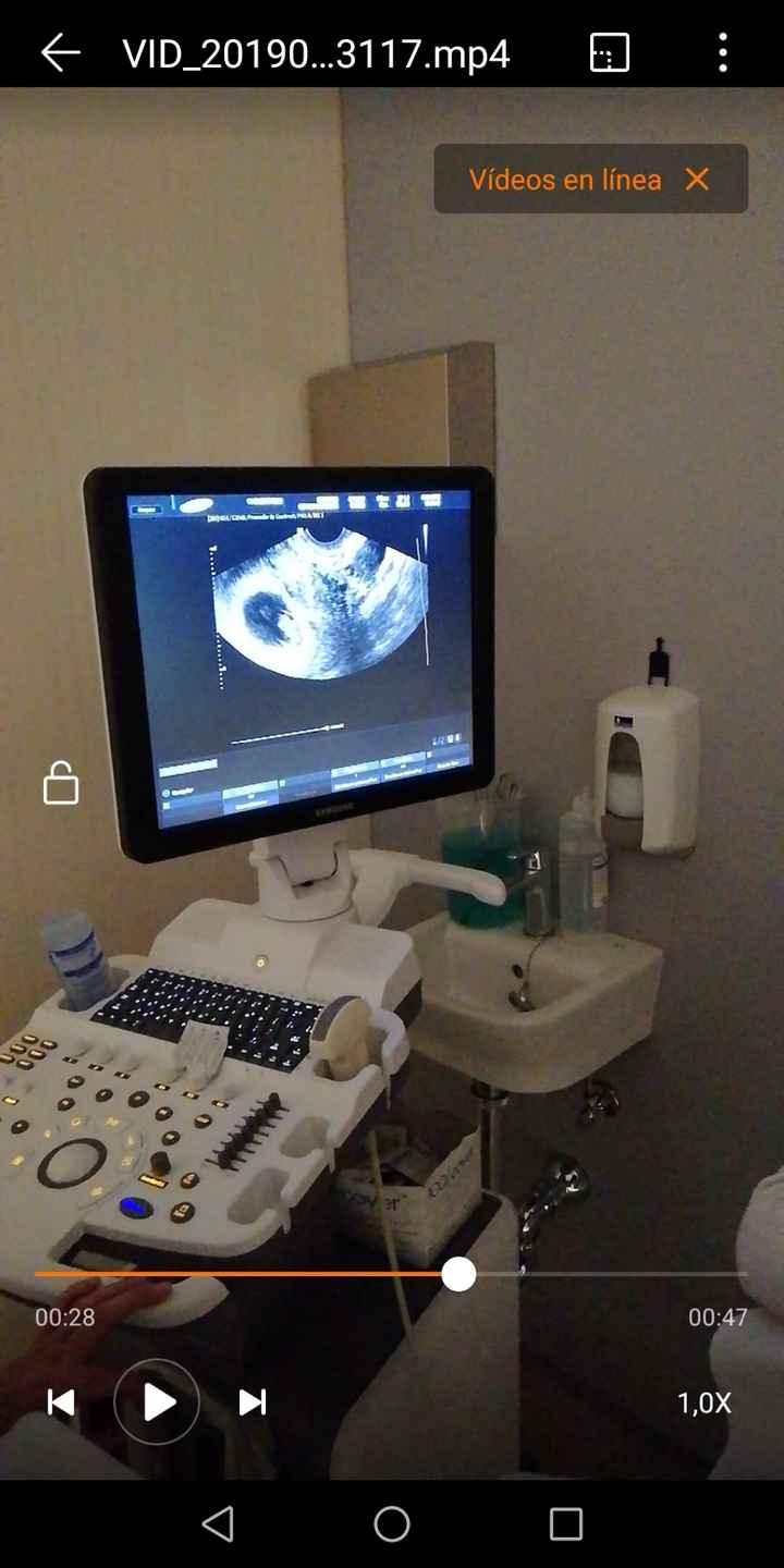 7+4 eco vaginal 